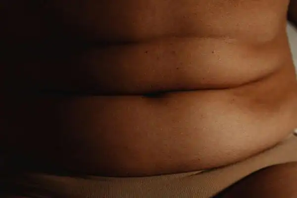 The Hidden Connection: How Stress Shapes Your Fitness and Body Composition 3 image of what stress can do on the stomach area and how Lipo 360 Buckinghamshire can help to change your body shape.